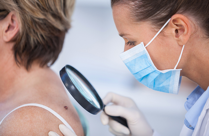Skin cancer prevention in primary care